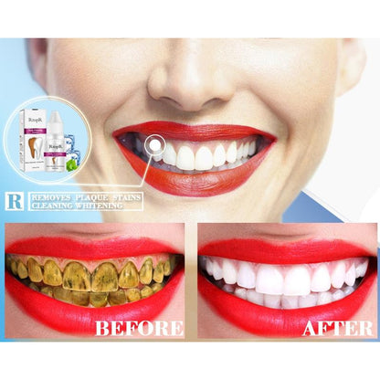 Teeth Whitening Kit Dental Cleanser 10ml by HitMyNeed