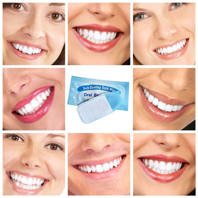 Teeth Wipes for On-the-Go Oral Care (50 pcs) by HitMyNeed