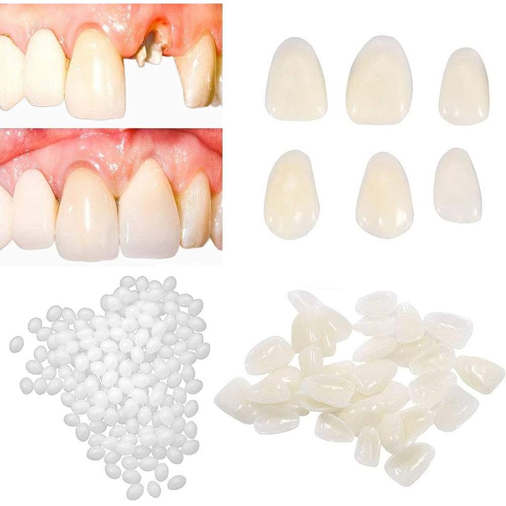 Temporary Fake Tooth Repair & Filling Bead Kit 15grams-with-opp-bag by HitMyNeed