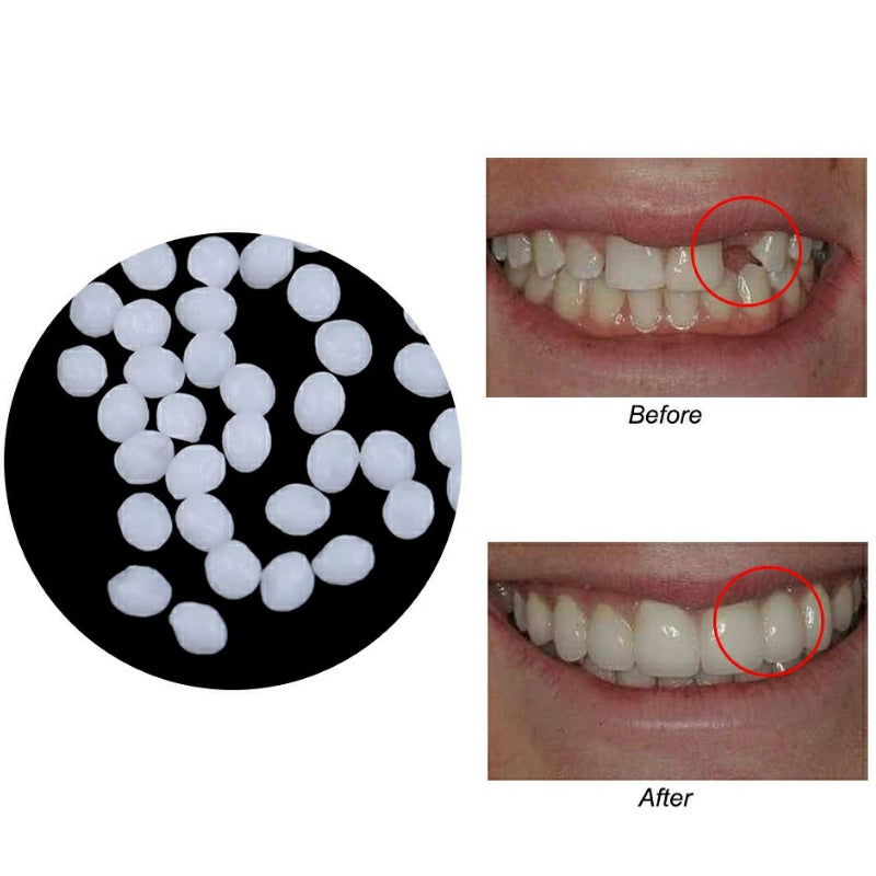 Temporary Fake Tooth Repair & Filling Bead Kit 25grams-with-opp-bag by HitMyNeed