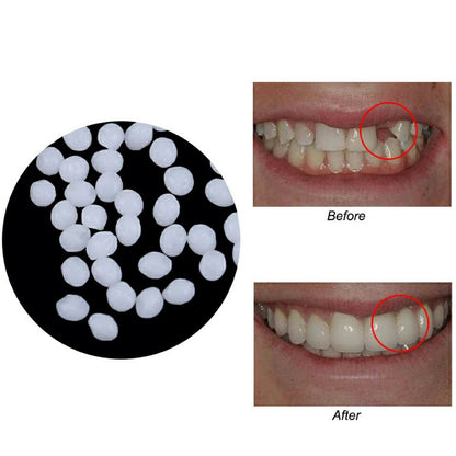 Temporary Fake Tooth Repair & Filling Bead Kit 25grams-with-opp-bag by HitMyNeed