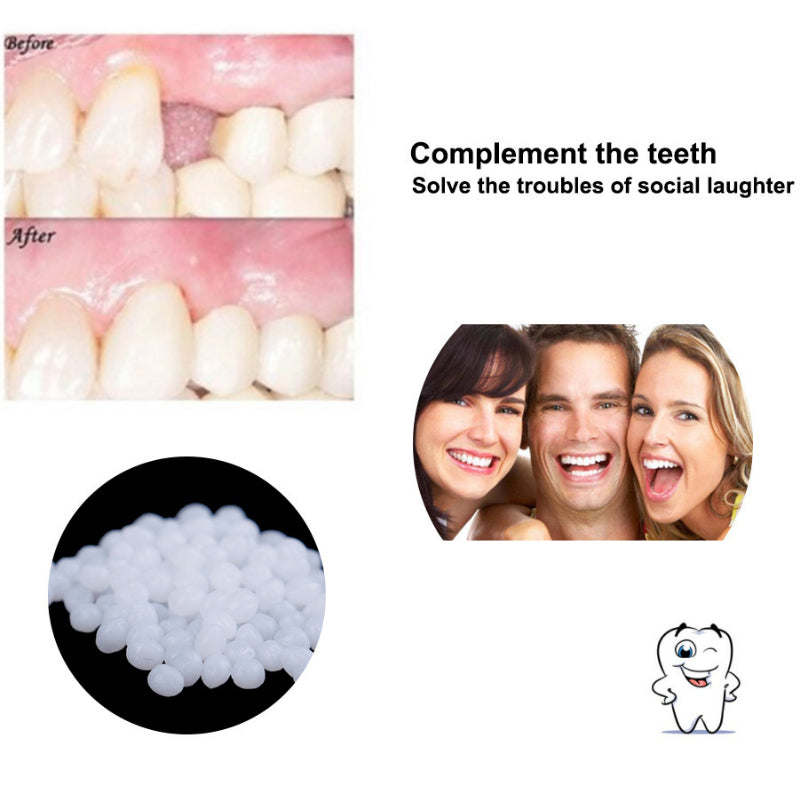 Temporary Fake Tooth Repair & Filling Bead Kit by HitMyNeed