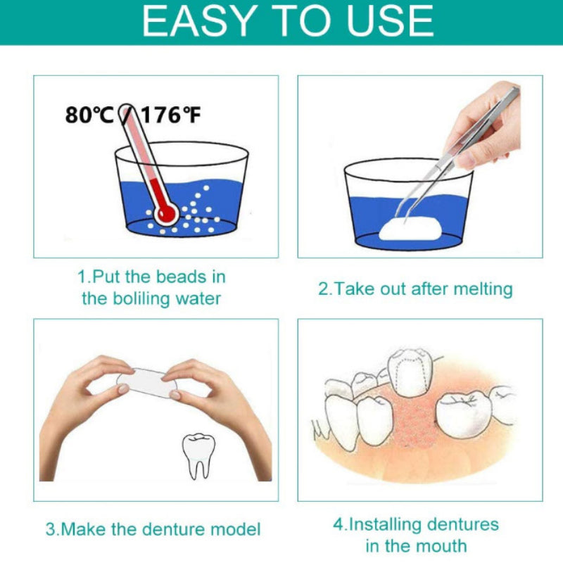 Temporary Fake Tooth Repair & Filling Bead Kit by HitMyNeed