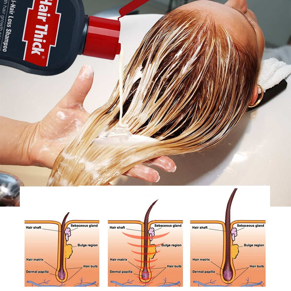 Thickening Shampoo Hair Growth Essence 100ml by HitMyNeed