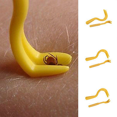 Tick Removal Tool Twister Hook Set (Pack of 2) by HitMyNeed