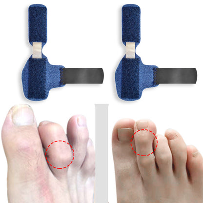Toe Splint Straightener for Hammer and Crooked Toes by HitMyNeed