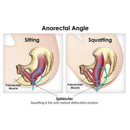 Toilet Squat Stool for Healthy Bathroom Posture by HitMyNeed