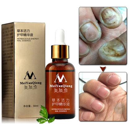 Topical Antifungal Nail Care Oil 30ml by HitMyNeed