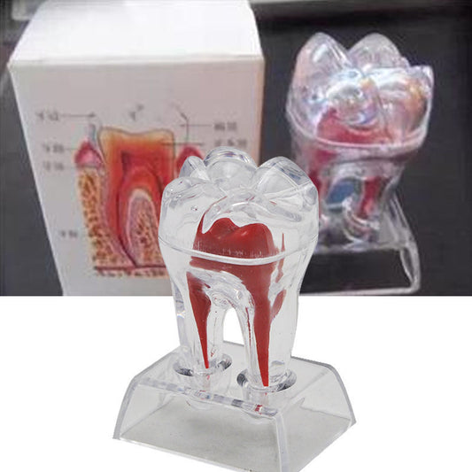 Transparent Molar Tooth Model with Crystal Stand by HitMyNeed
