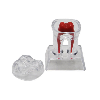 Transparent Molar Tooth Model with Crystal Stand by HitMyNeed