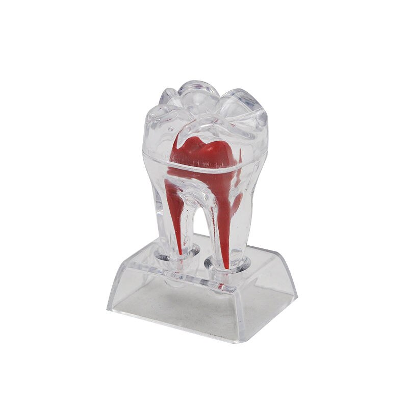 Transparent Molar Tooth Model with Crystal Stand by HitMyNeed