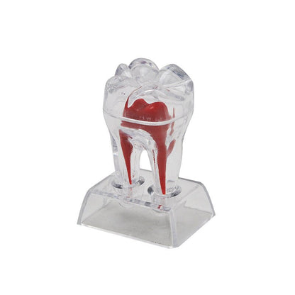 Transparent Molar Tooth Model with Crystal Stand by HitMyNeed