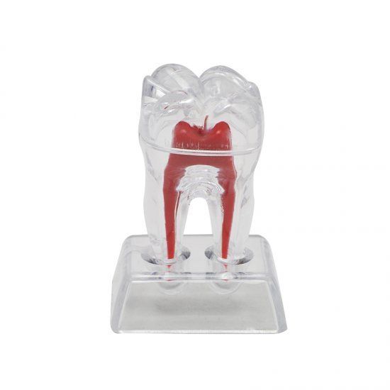 Transparent Molar Tooth Model with Crystal Stand by HitMyNeed