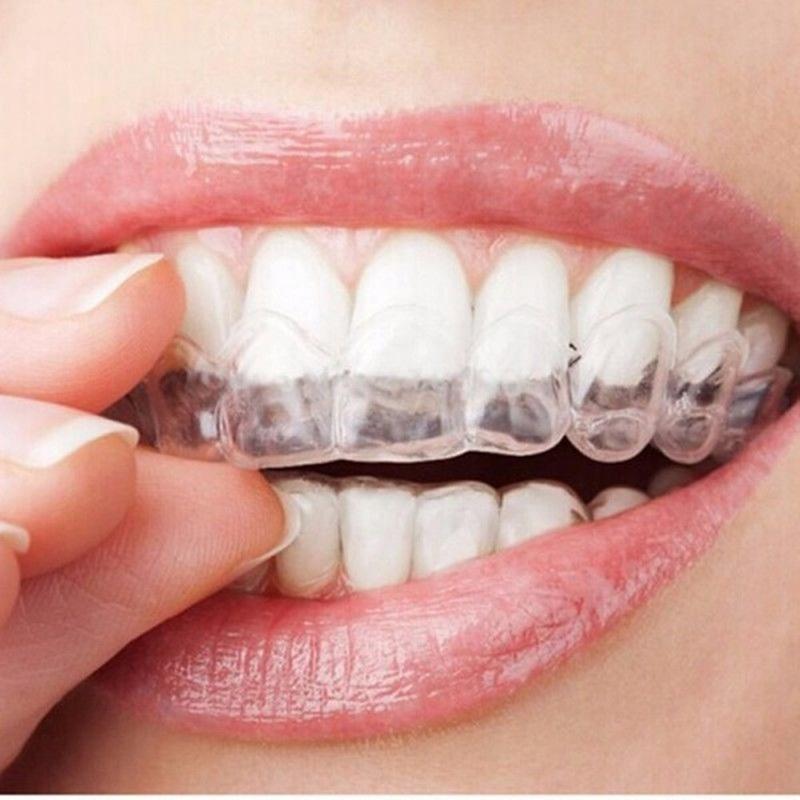 Transparent Night Guard Mouth Trays (Set of 2) by HitMyNeed