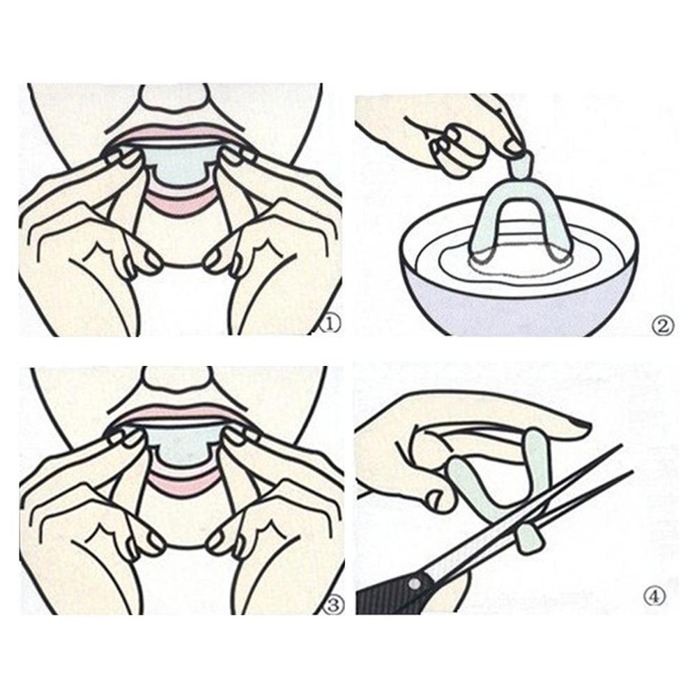 Transparent Night Guard Mouth Trays (Set of 2) by HitMyNeed