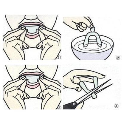 Transparent Night Guard Mouth Trays (Set of 2) by HitMyNeed