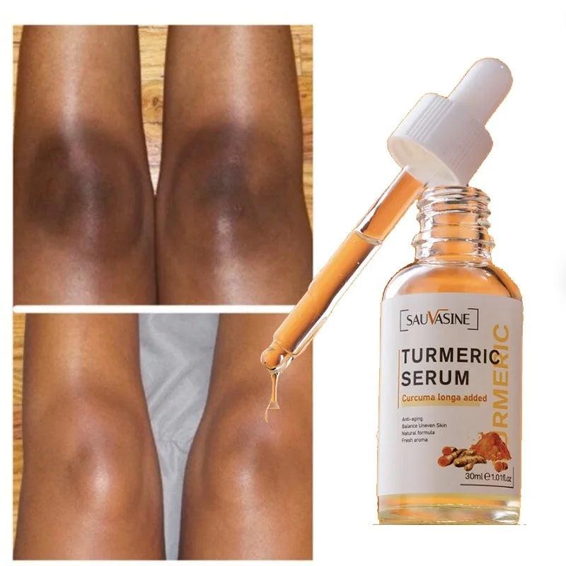 Turmeric Brightening Serum for Dark Spots & Acne by HitMyNeed