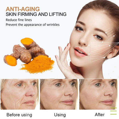 Turmeric Brightening Serum for Dark Spots & Acne by HitMyNeed