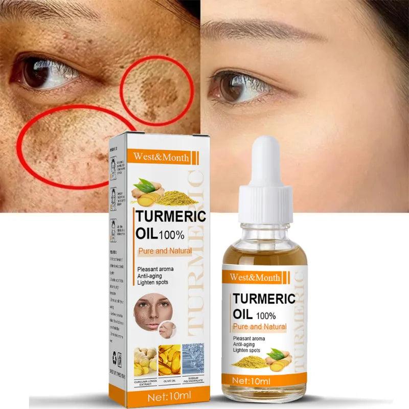 Turmeric Dark Spot & Anti-Wrinkle Face Serum 25g by HitMyNeed