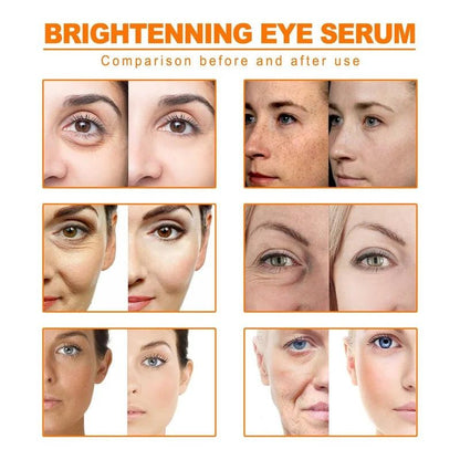 Turmeric Dark Spot & Anti-Wrinkle Face Serum 25g by HitMyNeed