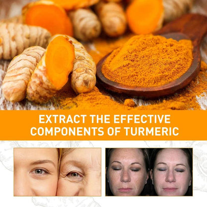 Turmeric Dark Spot & Anti-Wrinkle Face Serum 25g by HitMyNeed