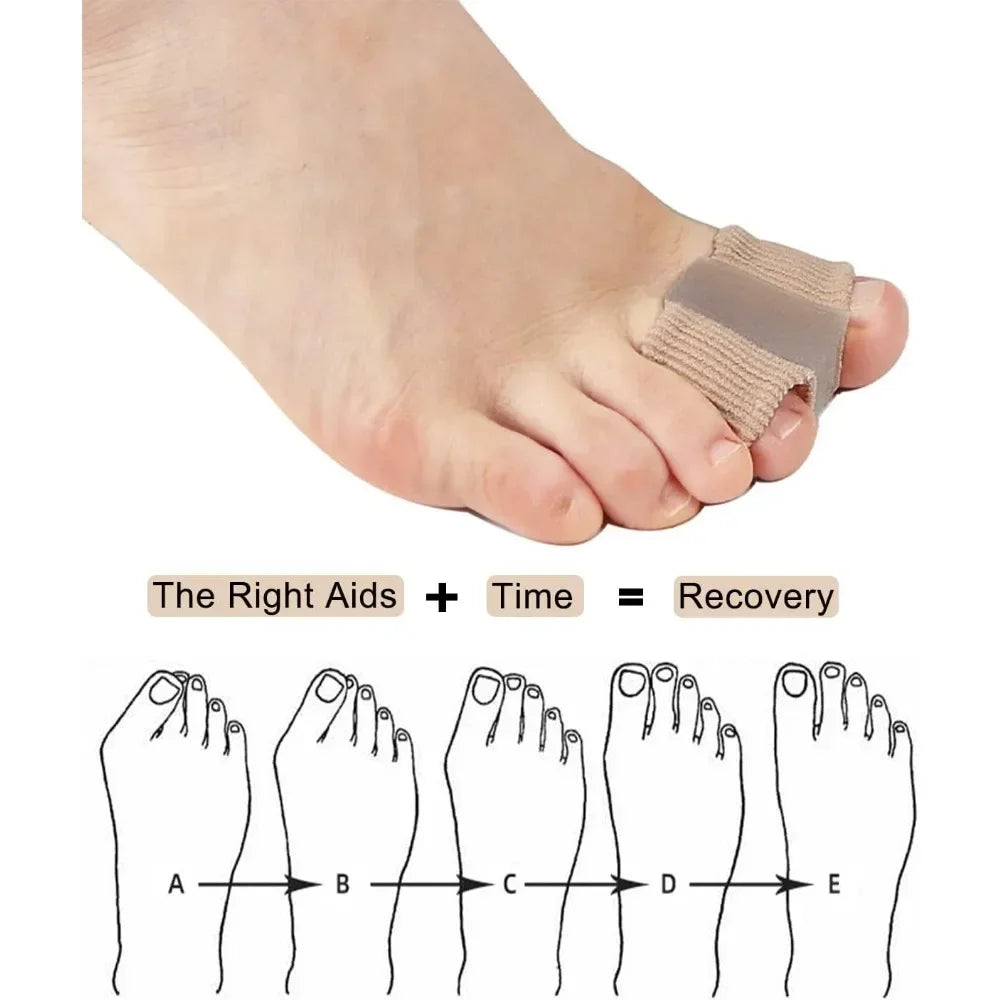 Two Toe Bunion Corrector Hallux Valgus Separator by HitMyNeed