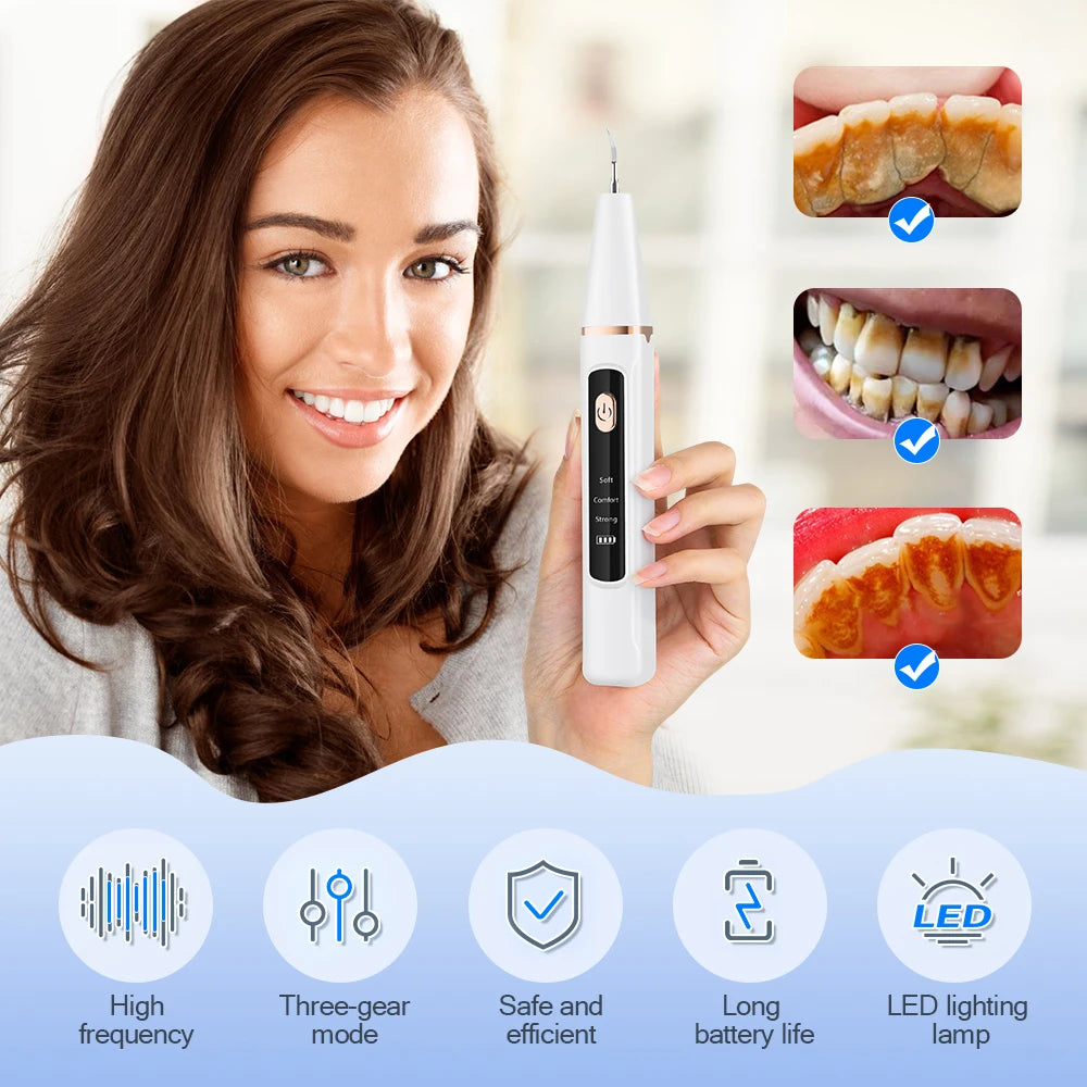 Ultrasonic Dental Scaler with LED for Home Tartar Care by HitMyNeed