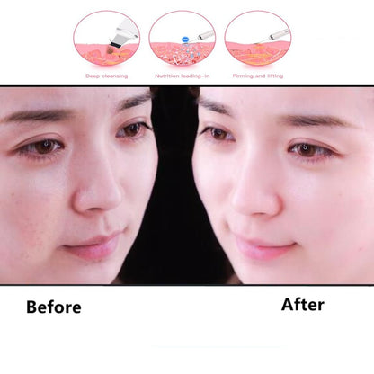 Ultrasonic Facial Skin Scrubber with 3 Care Modes by HitMyNeed
