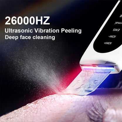 Ultrasonic Skin Scrubber Blackhead & Pore Cleaner by HitMyNeed