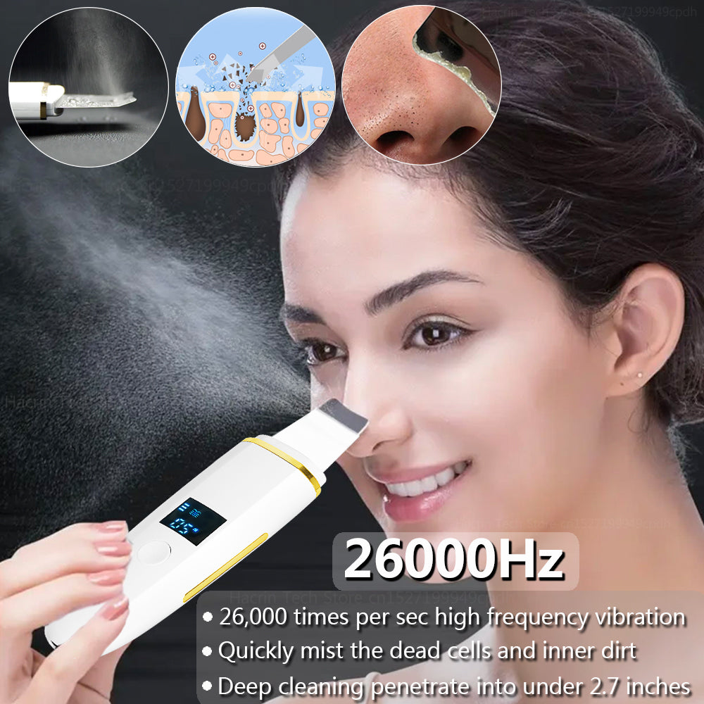 Ultrasonic Skin Scrubber Blackhead Remover by HitMyNeed