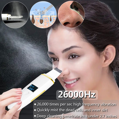 Ultrasonic Skin Scrubber Blackhead Remover by HitMyNeed