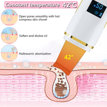 Ultrasonic Skin Scrubber Blackhead Remover by HitMyNeed