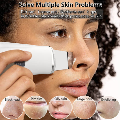 Ultrasonic Skin Scrubber with EMS Lifting by HitMyNeed