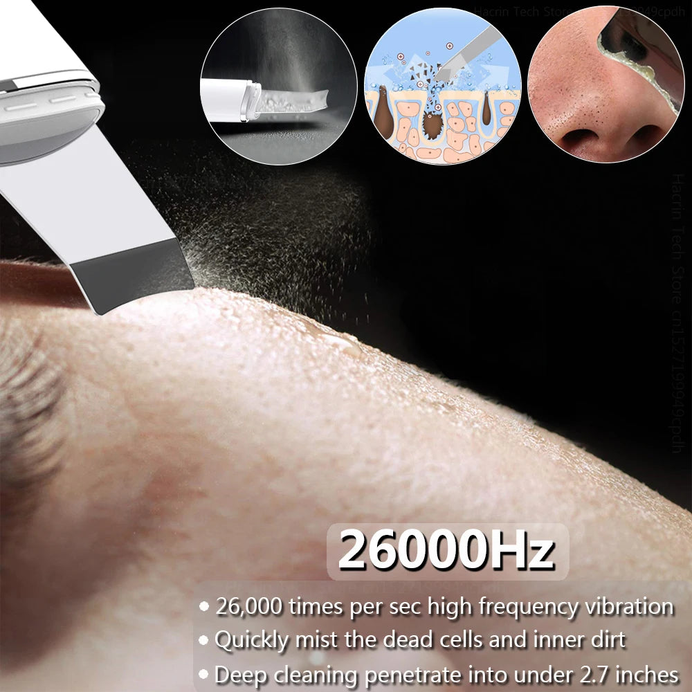 Ultrasonic Skin Scrubber with EMS Lifting by HitMyNeed