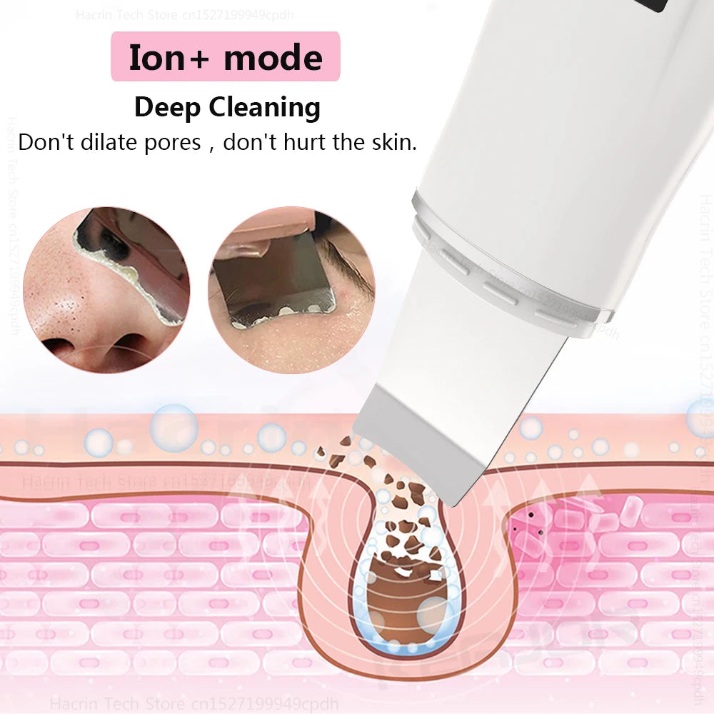 Ultrasonic Skin Scrubber with EMS Lifting by HitMyNeed