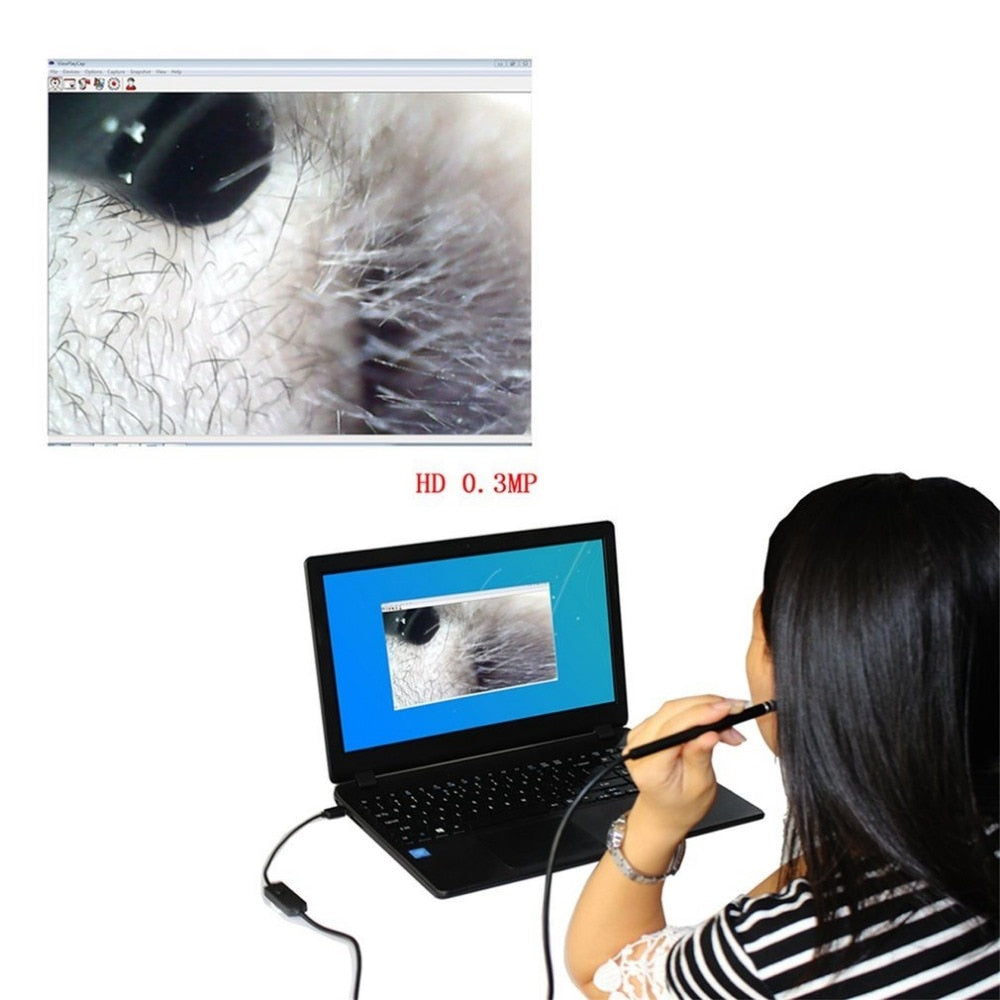 USB Digital Otoscope Earpick with Video Camera by HitMyNeed