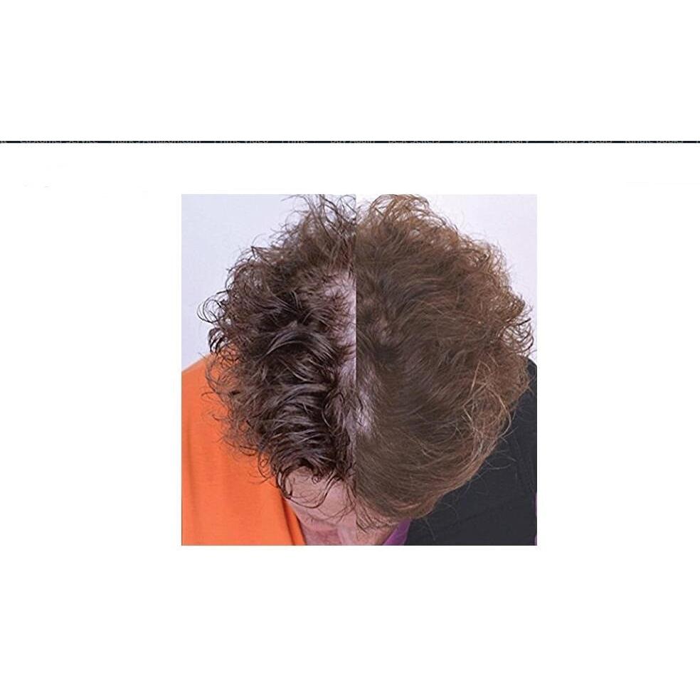USB Laser Hair Growth Cap for Thinning Hair by HitMyNeed