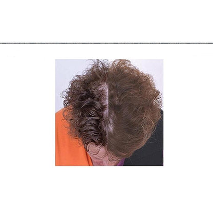 USB Laser Hair Growth Cap for Thinning Hair by HitMyNeed