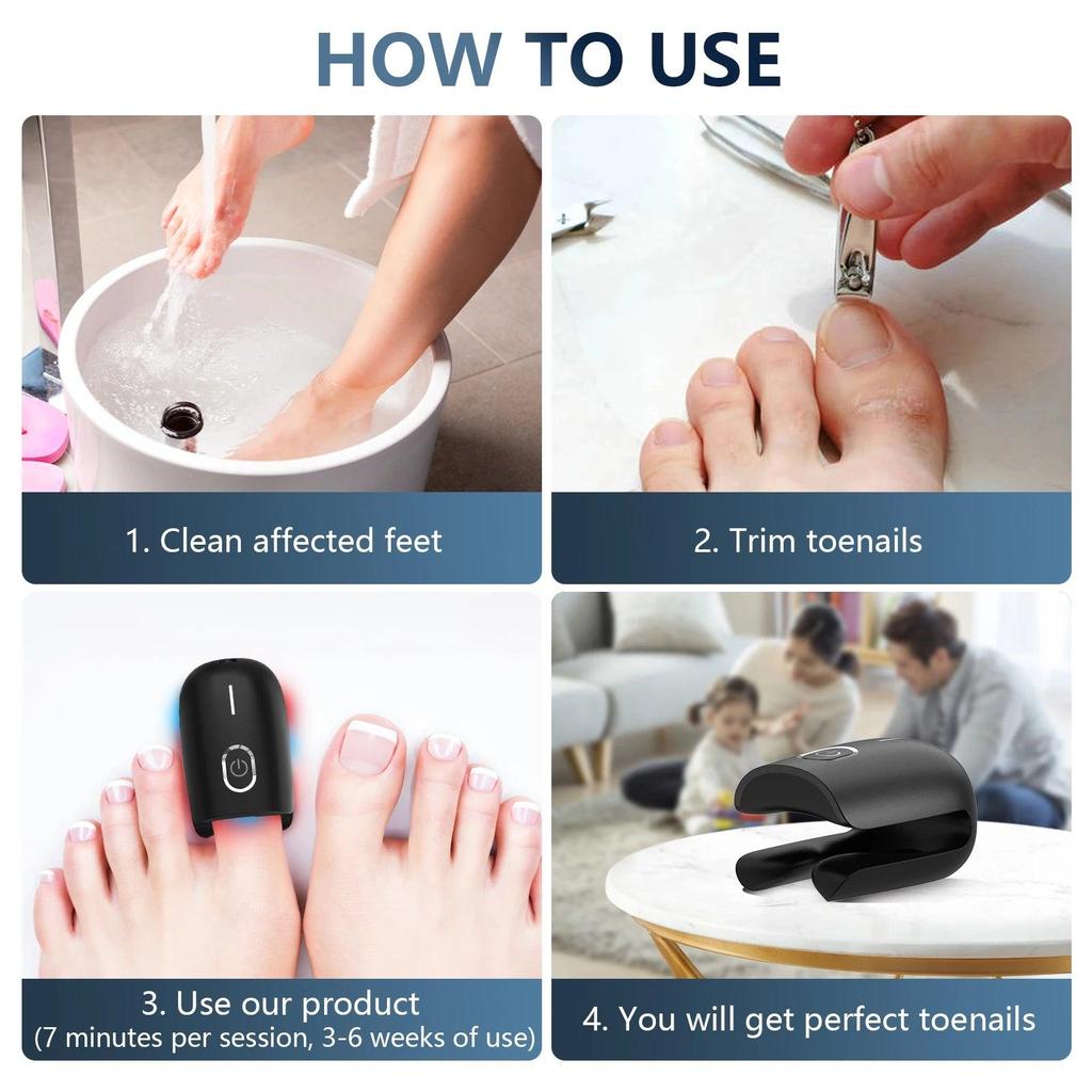 USB Rechargeable Nail Fungus Laser Therapy Device by HitMyNeed