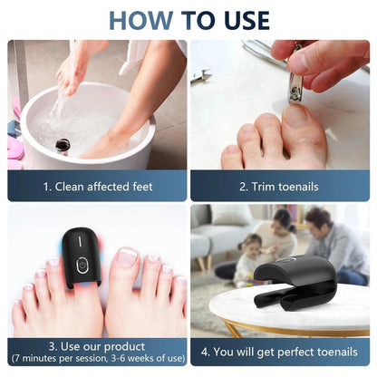 USB Rechargeable Nail Fungus Laser Therapy Device by HitMyNeed