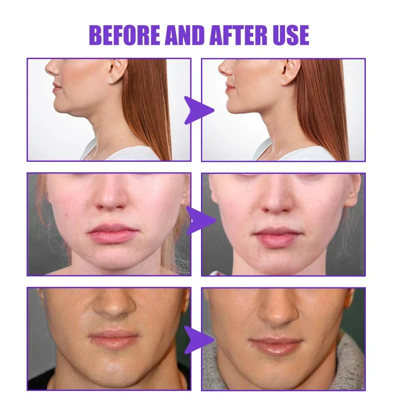 V-Shape Firming Face Cream for Jawline & Double Chin by HitMyNeed