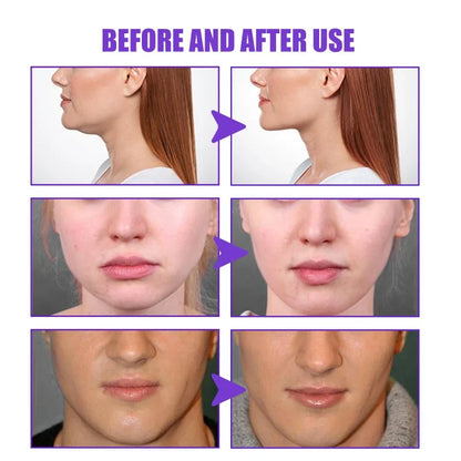V-Shape Firming Face Cream for Jawline & Double Chin by HitMyNeed