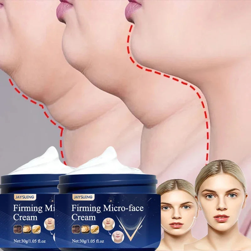 V-Shape Firming Face Cream for Jawline & Double Chin Five pcs (5) by HitMyNeed