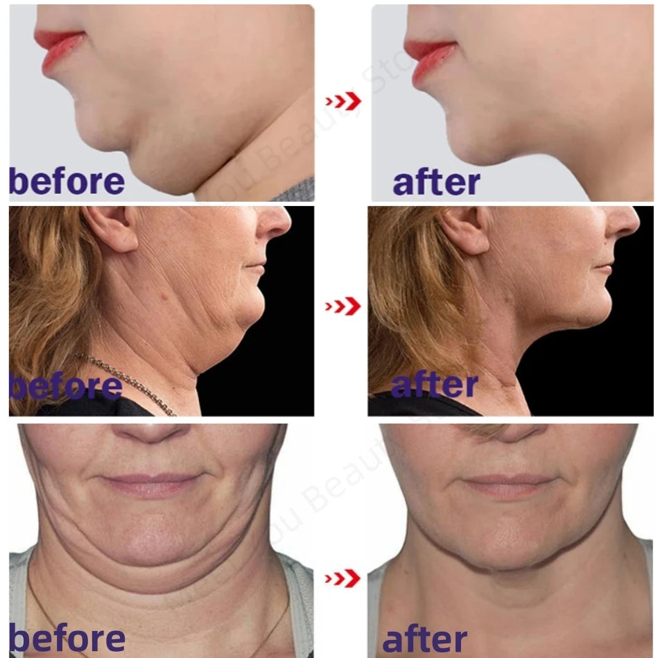 V-Shape Firming Face Cream for Jawline & Double Chin One pc (1) by HitMyNeed