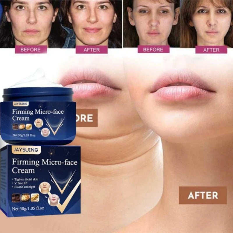 V-Shape Firming Face Cream for Jawline & Double Chin Three pcs (3) by HitMyNeed