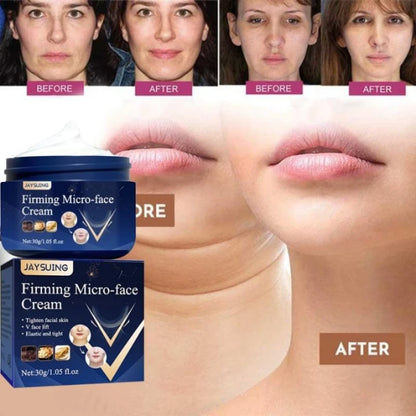 V-Shape Firming Face Cream for Jawline & Double Chin Three pcs (3) by HitMyNeed