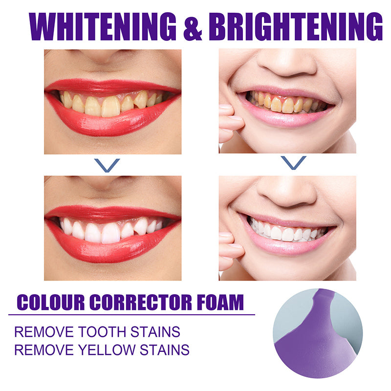 V34 Toothpaste Mousse Teeth Whitening 50ml by HitMyNeed