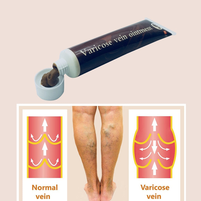 Varicose Vein Relief Herbal Cream Ointment 20g by HitMyNeed