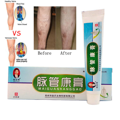 Varicose Veins Treatment Ointment by HitMyNeed