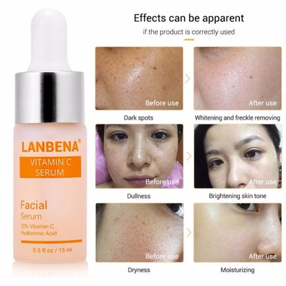 Vitamin C Anti-Aging Face Serum with Hyaluronic Acid by HitMyNeed